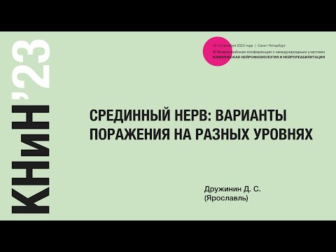 Видео: Срединный нерв: варианты поражения на разных уровнях. Дружинин Д. С.