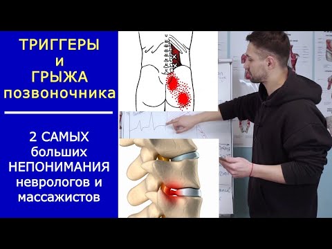 Видео: Триггерные точки и Грыжа диска   2 самых больших непонимания