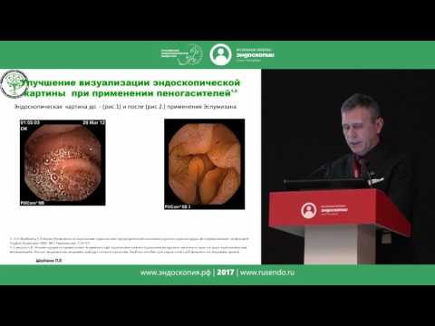 Видео: Нюансы визуализации слизистой оболочки кишечника при капсульной колоноскопии