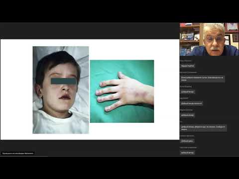 Видео: Портальная гипертензия у детей - Разумовский А.Ю.