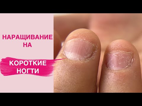 Видео: Наращивание ногтей на КОРОТКИХ НОГТЯХ