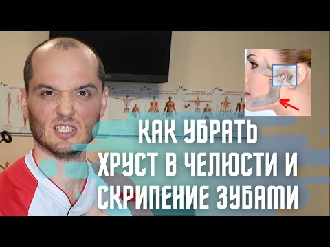 Видео: Щёлкает челюсть+двнчс. Дисфункция ВНЧС. Лечение ВНЧС и остеопатия