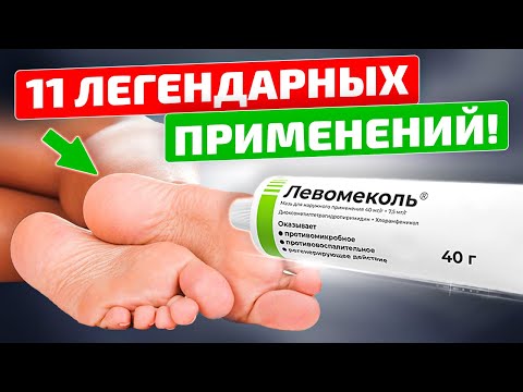 Видео: Левомеколь: Дешевый, но бесценный! 11 рецептов лечения простым препаратом