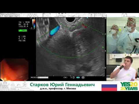 Видео: 14. ЭУС/ЭРХПГ. Ю. Г. Старков, С. В. Джантуханова