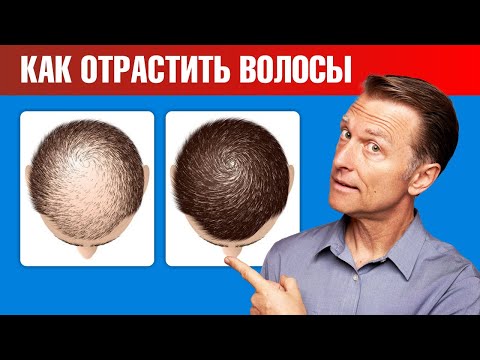 Видео: Как остановить выпадение волос и вновь отрастить волосы?🤔