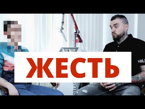 Видео: 200.000 РУБЛЕЙ НА ВЕТЕР! КАК НЕ НУЖНО УДАЛЯТЬ ТАТУИРОВКИ!