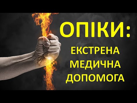 Видео: ОПІКИ (Опіковий Шок, Опікова Хвороба): Види, Ступені, Медична допомога та часті помилки