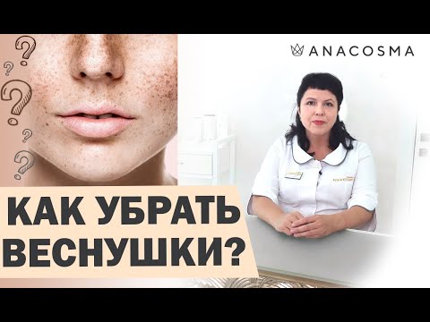 Видео: Как убрать веснушки☀️ Удалить веснушки - это навсегда?☀️