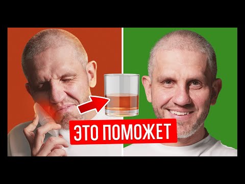 Видео: Воспалились дёсны? 3 ЛУЧШИХ способа снять отёк за 5 минут!