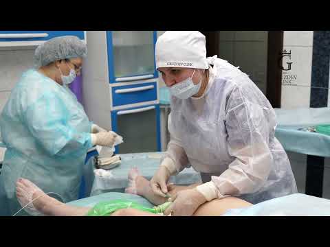 Видео: ЭВЛК и минифлебэктомия