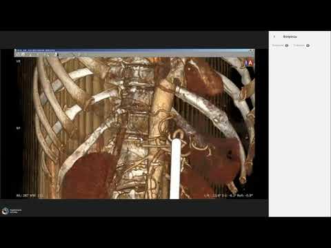Видео: Техника написания заключений КТ  Опухоли поджелудочной железы