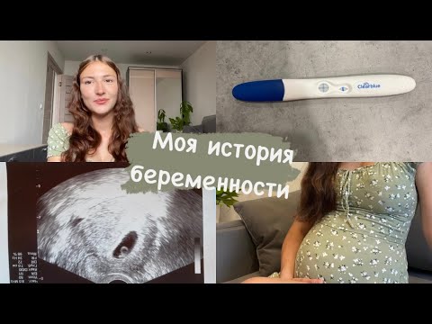 Видео: Моя история беременности🤰🏻