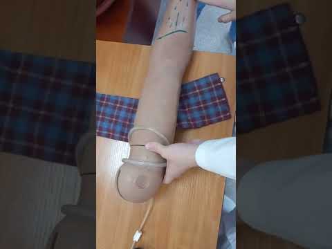 Видео: Уақытша қан кетуді тоқтату. Жгут салу| Алгоритм временной остановки кровотечение