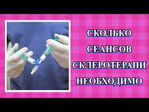 Видео: Сколько сеансов склеротерапии нужно