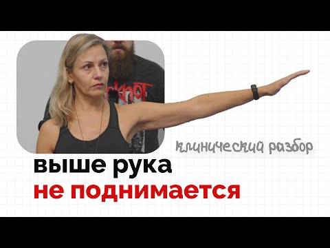 Видео: Плечо не поднимается? | Клинический разбор