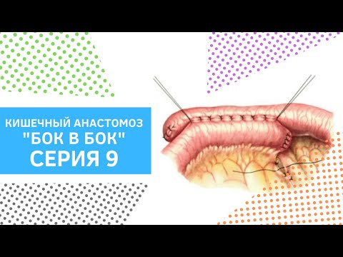 Видео: Серия 9. Кишечный анастомоз бок в бок