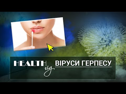 Видео: «Health - гід» Віруси герпесу