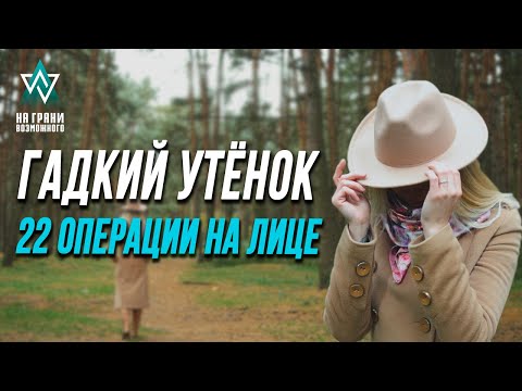 Видео: «Гадкий утёнок» | НА ГРАНИ ВОЗМОЖНОГО