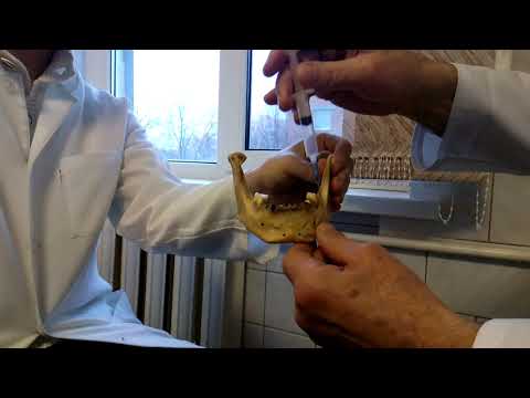 Видео: Ментальная анестезия