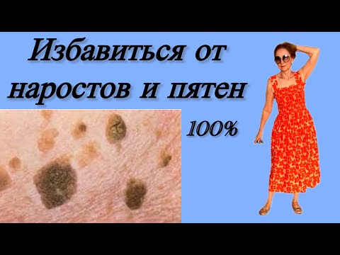 Видео: 🟡🔵  Как  избавиться от пятен и наростов на коже ( теле )…. НАВСЕГДА 