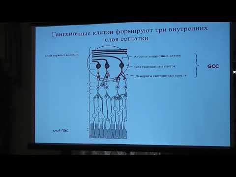 Видео: Диагностика глаукомы От ОКТ к ангио ОКТ