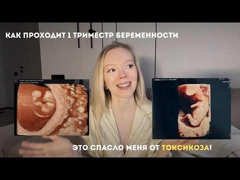 Видео: Я БЕРЕМЕННА. Что делать после двух полосок? Как справиться с токсикозом?
