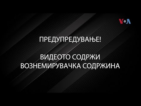 Видео: Вознемирувачка содржина: Петардите можат да ве осакатат за цел живот
