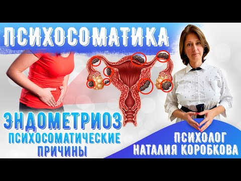 Видео: ПРИЧИНЫ ЭНДОМЕТРИОЗА/Как вылечить навсегда!