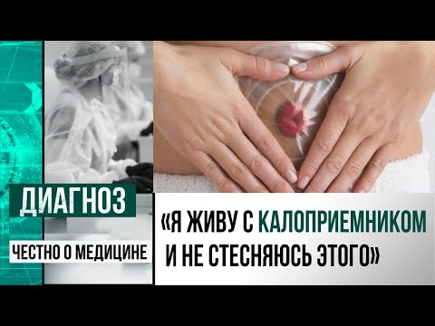 Видео: Стома – не приговор: как жить, если удалён кишечник? | Диагноз