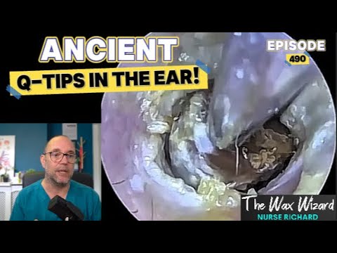 Видео: ДРЕВНИЕ ВАТНЫЕ ПАЛОЧКИ В УШАХ! Эпизод 490 (точно 1, возможно 2!)