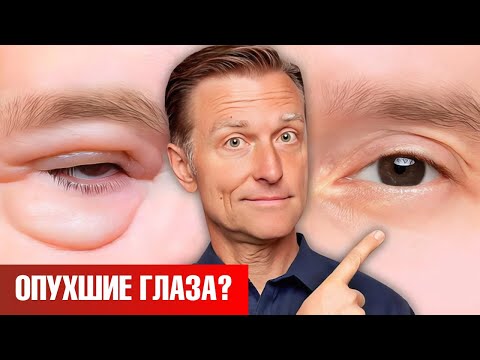 Видео: Как убрать мешки под глазами НАВСЕГДА? 🧐