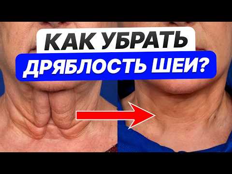 Видео: КРАСИВАЯ шея за 3 ПРОСТЫХ упражнения! / Как убрать кольца Венеры на шее?