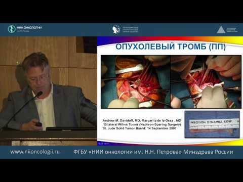 Видео: Хирургический этап лечения опухоли Вилмса
