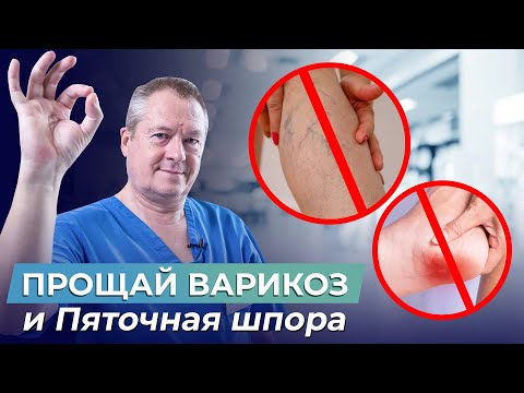 Видео: Осторожно, ПЯТОЧНАЯ ШПОРА! Как СНЯТЬ ОСТРУЮ БОЛЬ и даже УБРАТЬ ВАРИКОЗ за 2 месяца?