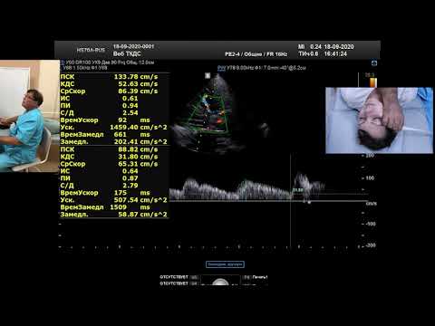 Видео: Стандартизованное транскраниальное дуплексное сканирование (ТКДС) (профессор Куликов В.П.)