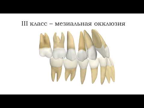 Видео: Классификация по Энглю