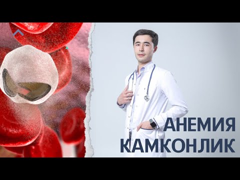 Видео: КАМКОНЛИК | АНЕМИЯ САБАБИ, ДАВОЛАШ ВА ОЛДИНИ ОЛИШ