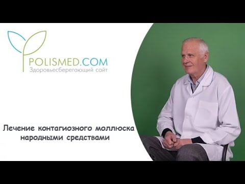 Видео: Лечение контагиозного моллюска народными средствами: йод, чистотел, фукорцин, деготь