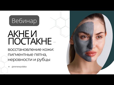 Видео: Вебинар | Восстановление кожи с акне и постакне: пигментные пятна, неровности и рубцы 📝