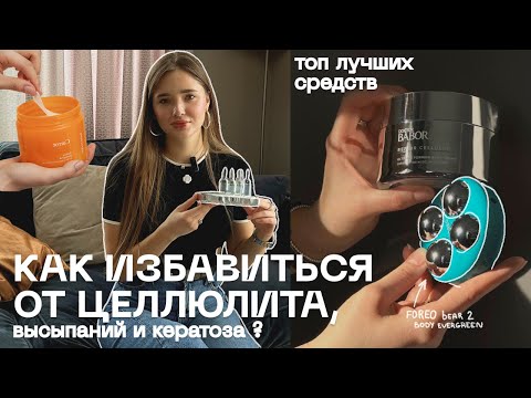 Видео: КАК ИЗБАВИТЬСЯ ОТ ЦЕЛЛЮЛИТА, ВЫСЫПАНИЙ И ФОЛЛИКУЛЯРНОГО КЕРАТОЗА?