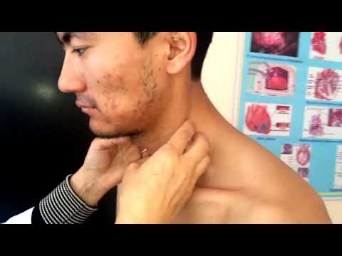 Видео: Калканша бези пальпациясы Қалқанша без пальпация Ішкі аурулар пропед практика чеклист мкту медицина