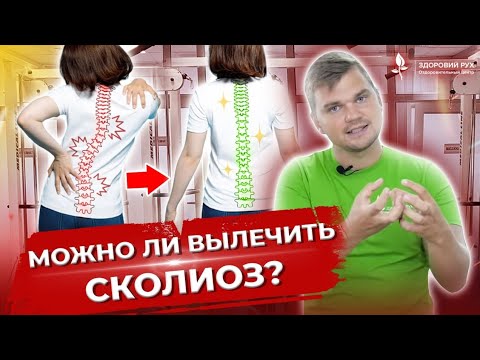 Видео: Можно ли вылечить сколиоз?