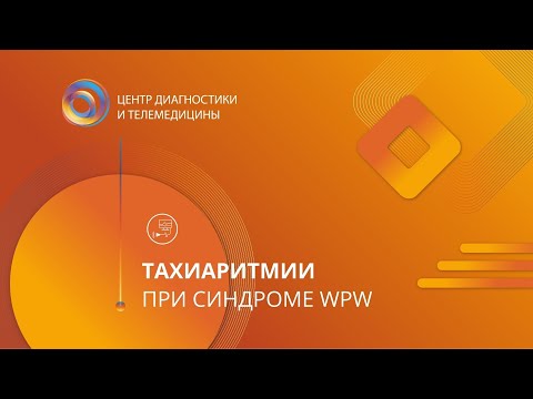 Видео: Тахиаритмии при синдроме WPW