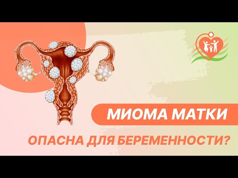 Видео: 🤰  Миома матки опасна для беременности?