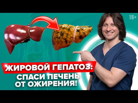 Видео: Опасность ЖИРНОЙ ПЕЧЕНИ! Как лечить ЖИРОВОЙ ГЕПАТОЗ? Симптомы, диагностика и ДИЕТА для печени