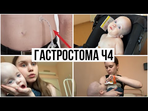 Видео: Кормлю Через Стому и Едем Домой