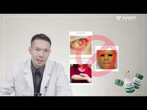 Видео: Элэгний өвчний үед ямар шинж тэмдэг илэрдэг вэ?