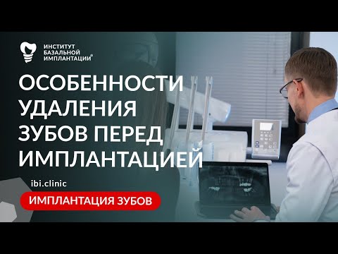 Видео: Зачем удалять зубы перед базальной имплантацией – особенности и показания к удалению