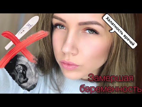 Видео: Замершая беременность на раннем сроке