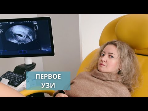 Видео: Первое УЗИ при беременности